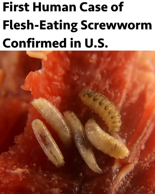 അമേരിക്കയിൽ മനുഷ്യരിൽ ആദ്യമായി ‘സ്ക്രൂവേം’ അണുബാധ റിപ്പോർട്ട് ചെയ്തു