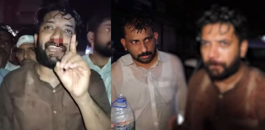 ഷാഫി പറമ്പില് എംപിക്ക് പരുക്കേറ്റ സംഭവം: സംസ്ഥാന വ്യാപക പ്രതിഷേധത്തിന് ആഹ്വാനം ചെയ്ത് കോണ്ഗ്രസ്